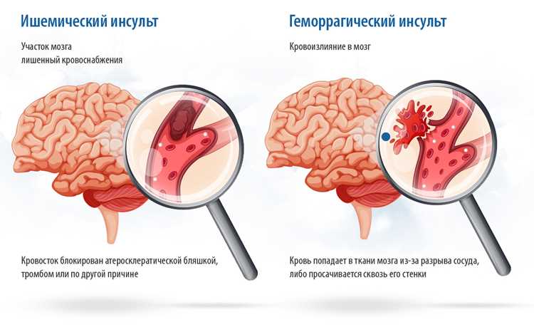 Ошибки в акцентуации и их последствия для коммуникации